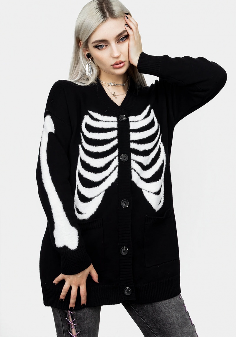 Disturbia Skeletus Oversized Cardigan | YYC-49013837