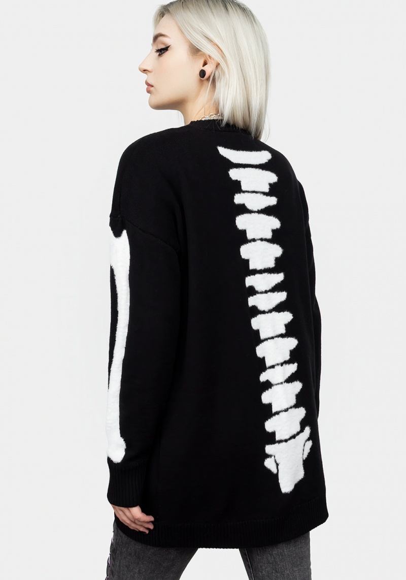 Disturbia Skeletus Oversized Cardigan | YYC-49013837