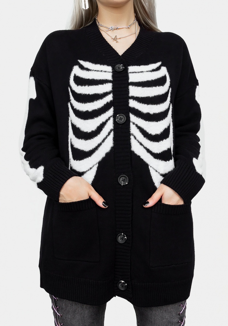 Disturbia Skeletus Oversized Cardigan | YYC-49013837