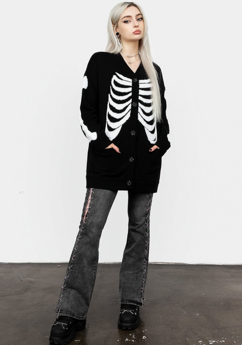 Disturbia Skeletus Oversized Cardigan | YYC-49013837